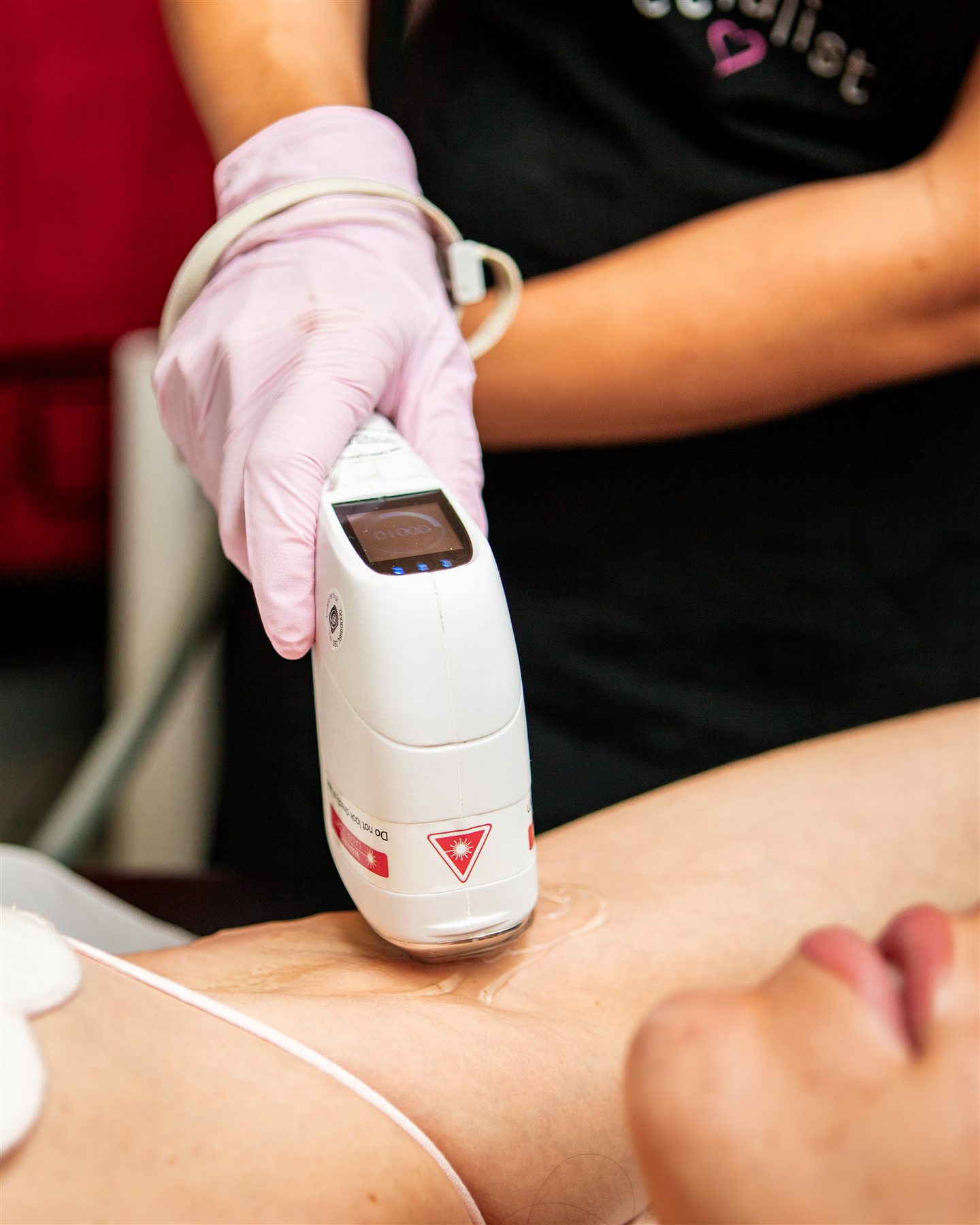 Laserbehandlung im Brustbereich mit Schutzbrille und gekühltem Handstück